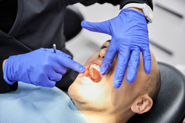 Best Emergency Dental Care for Sports Injuries in Canton, MS